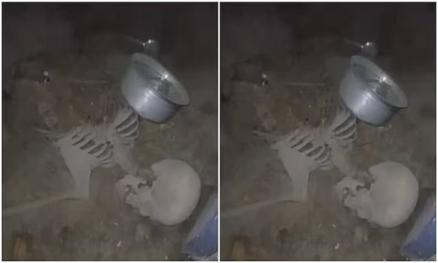 Human Skelton Nampally