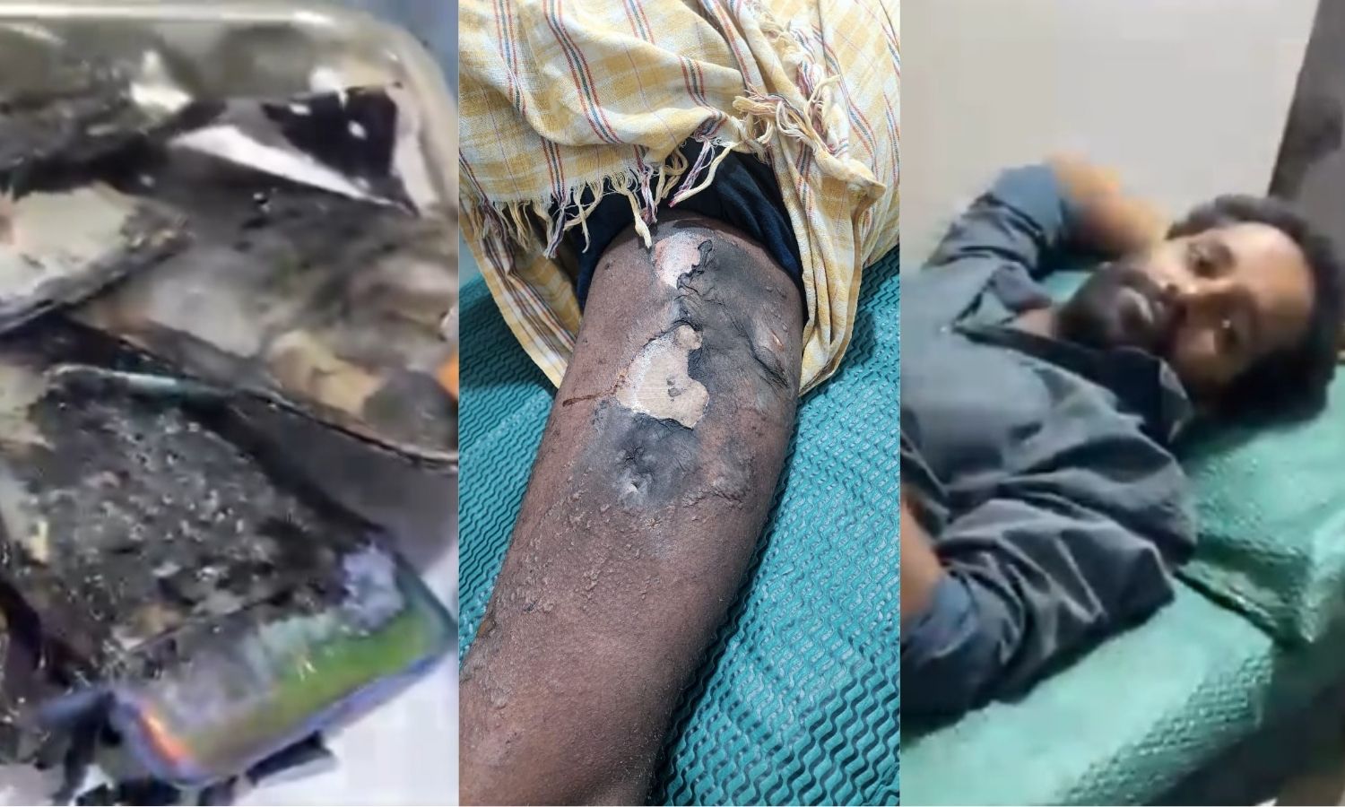 Smartphone Explodes